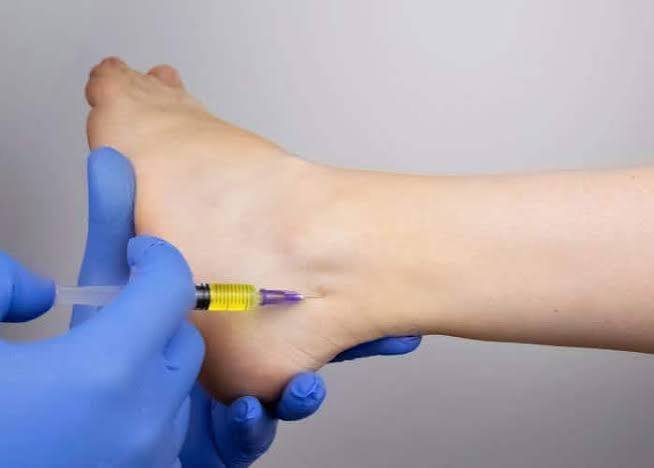 Growth factor injection being given into a patient’s ankle at RMC Mangalore